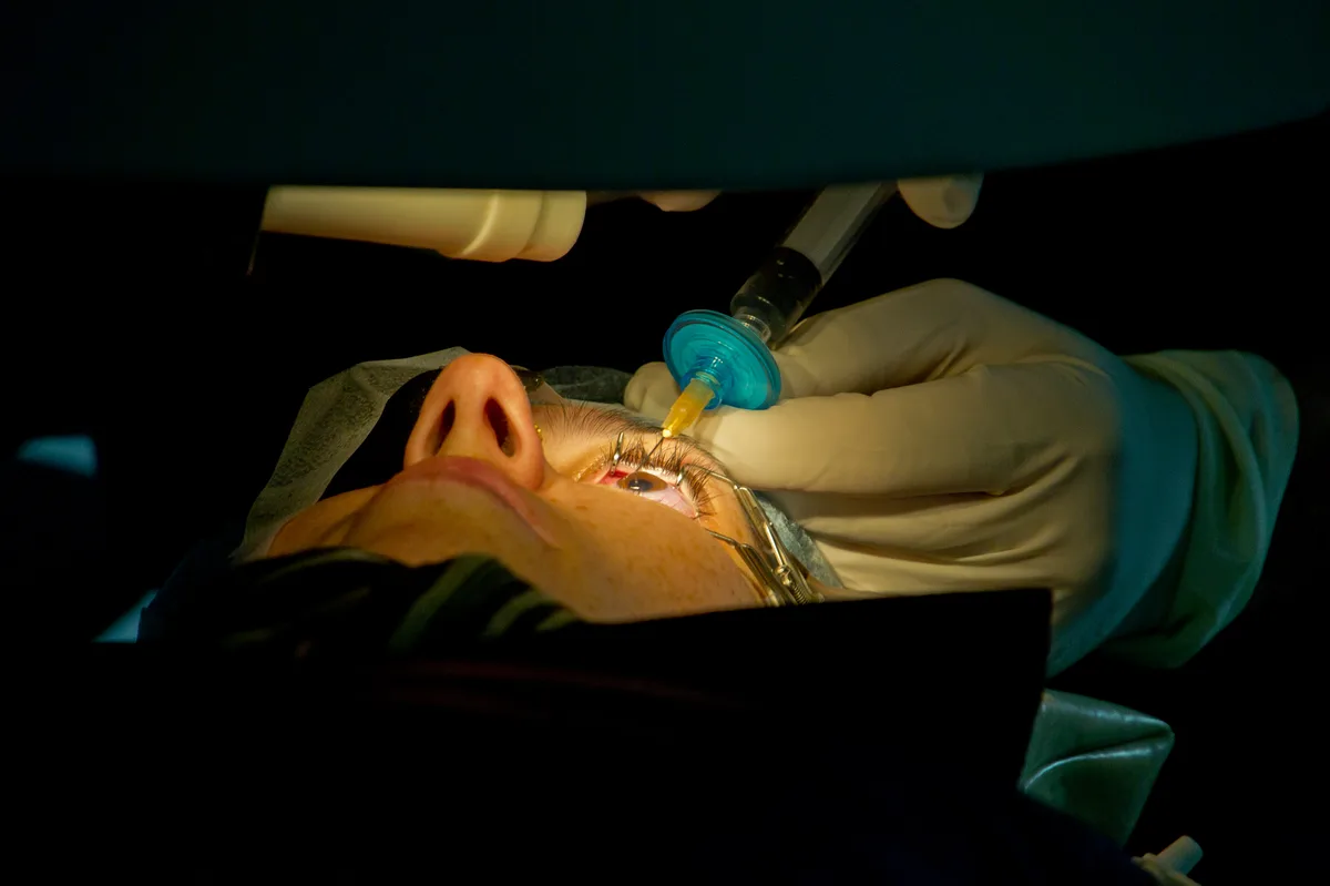 LASIK ooglaserbehandeling in operatiekamer — chirurg gebruikt laser om hoornvlies te corrigeren
